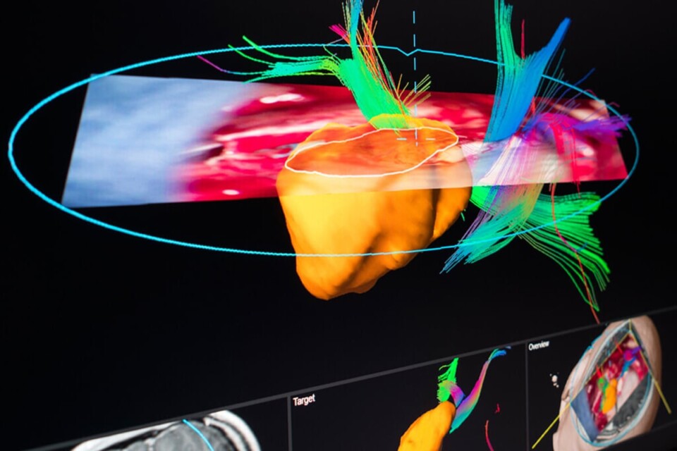 Digital health, Brainlab, 3D imaging